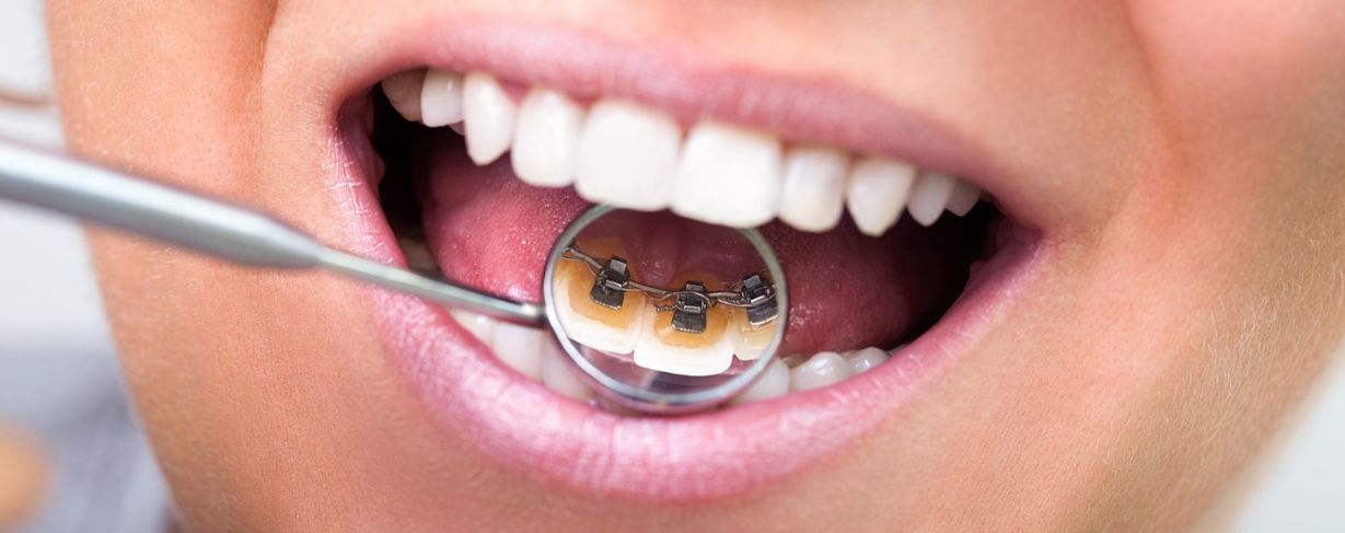 Soins orthodontie – Équipements modernes pour traitements avancés