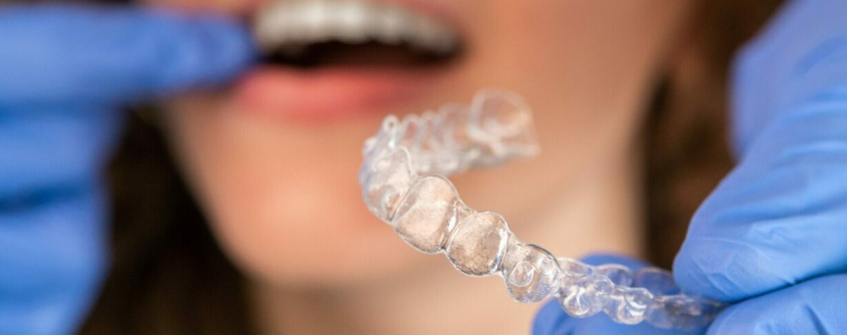 "Soins orthodontie – Appareils DAMON, Invisalign, et Incognito